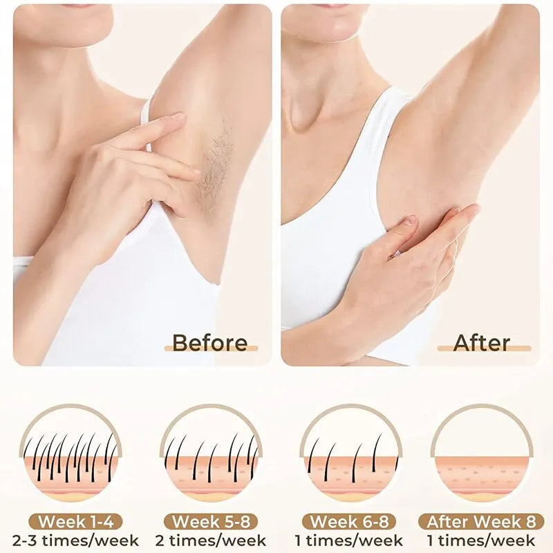 IPL Hair Removal Device for Women & Men  Permanent Painless Epilator